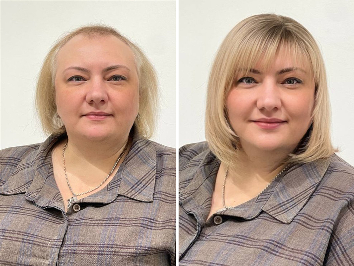 https://umnyevolosy.ru/wp-content/uploads/2022/12/женщина-в-системе-волос-до-и-после-лицом-optimized.jpg